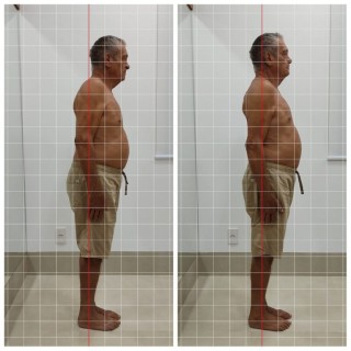 Antes e depois