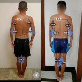 Antes e depois