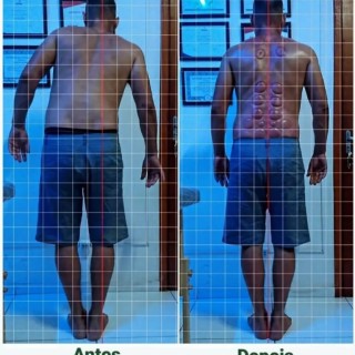 Antes e depois