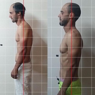 Antes e Depois