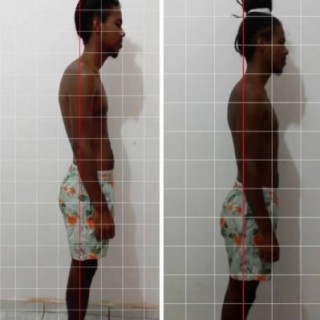 Antes e depois