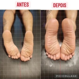Antes e depois alinhamento