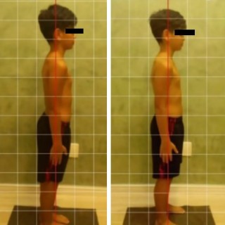 Antes e depois de criança com Seitai